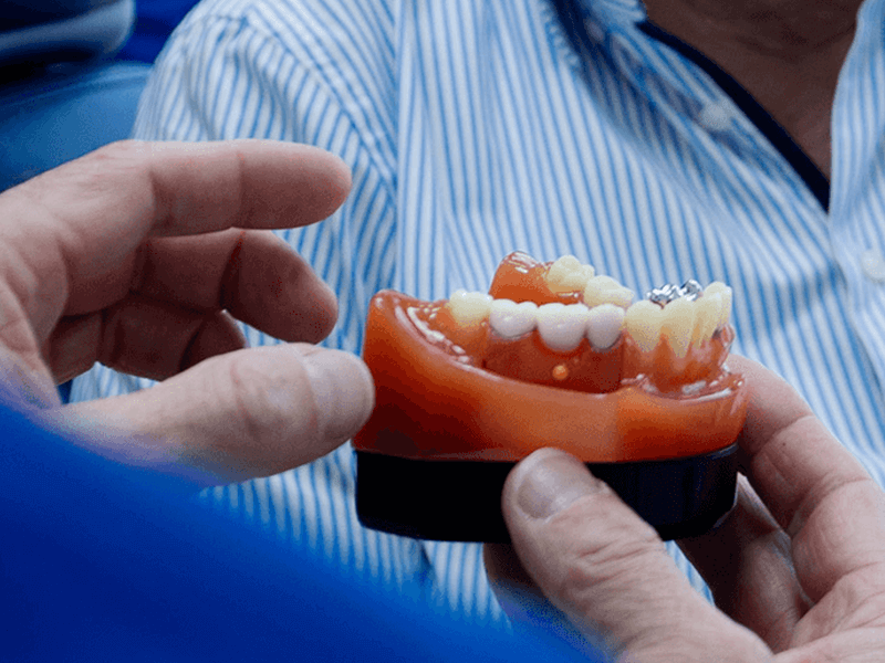 Praxis Schreiner – Leistungen Übersicht Zahnfleischbehandlung